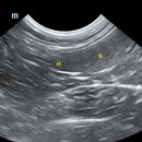 병소농장 이미지