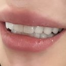 역삼역 임플란트 전문 치과 잘하는 곳 좋아요 추천 List 6곳