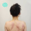 청라바다약국 | 청라바디관리: 커낼에비뉴 바른에스테틱, 목 어깨 상체 하체 테라피