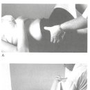 Pelvic out-flare 이미지