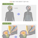 키아리