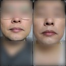 애터미 비비크림 후기 (Feat. 면도 후 수염 자국을 가릴 수 있을까?)