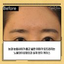 노블성형외과의원 이미지