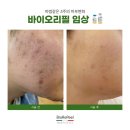 쉼필 | 창원피부관리 바이오리필 '쉼에스테틱 창원점'
