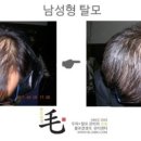 불로장생모