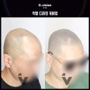 디비전 스칼프 이미지