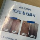 하늘피부관리실 | 등여드름 해초필 등드름 해결 후기｜명지피부관리실 레브에스테틱 웨딩관리 추천