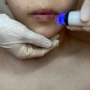 루나뷰티 | [원주] 원주피부관리 루나뷰티 후기