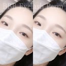 브로우바이빈
