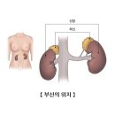 부신피질호르몬 이미지