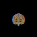 리버스의원 이미지