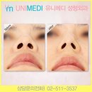 이미그레이션