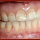 능곡치과의원 이미지