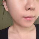 올포스킨피부과의원 | 압구정 피부과 ㅎㅇㄷ의원, 올리디아 콜라겐스킨부스터 후기 큐어젯으로 받아본 리얼 후기