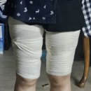 후하바이오 | &#34;광주지방추출주사 한달차&#34; 허벅지 복부 내돈내산 솔직후기 붓기