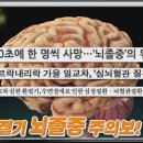 뇌졸중 이미지