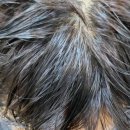 남자복구매직케어 잦은염색과펌극손상모발원형탈모 환장하네~ / 사상괘법주례화명명지녹산장유김해양산주례개금하단다대부전서면전포양정연제연산동래사직 이미지