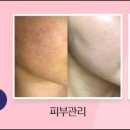 약손스킨케어 이미지