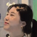 디마레의원 | 디마레성형외과 얼굴지흡 1일차,3일차 리얼후기