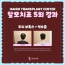 전주 탈모관리 후기의 중요성과 봐야 할 요소들