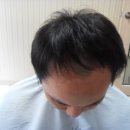 현미가발 네이버블로그