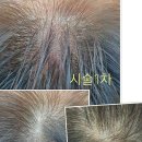주은헤어라인
