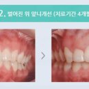 손고운치과의원 네이버블로그