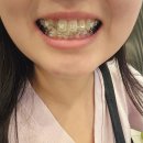 CU북삼행복점 | 완전체 교정 시작! 이래저래 요지경 한주