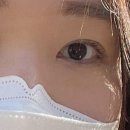 해전실비 | [pro-리뷰어] 눈 밑 점막점, 특수점 제거 정보 및 후기