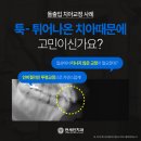길동치과의원 | 입툭튀 고민 개선 ! 길동치과추천, 둔촌동돌출입교정 교정 실제 사례