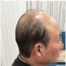에띠모 이미지