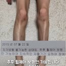 하반신마비 이겨낸 남자 이미지