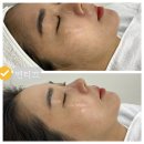 봉구상회소촌라인점 | 강동역] 연티끄 에서 스킨플래닝 으로 피부톤업 + 깐달걀+ 얼굴조명킨 찐후기