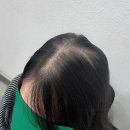더 채움 스칼프