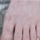 매료네일 문제성전문점 | 서면네일 샵 부전동내성발톱 뽑지 않고 개선하고 싶다면 매료네일in뷰티