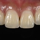 엠웍스 치과기공소 이미지