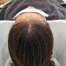 양주옥정웨딩관리 뷰티온 피부&amp;헤드스파 두피관리 후기
