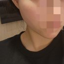 토르 | 브이토르 받은 후기 비브이주사 및 토르리프팅