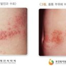 가산곧바로의원 이미지