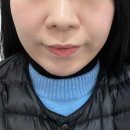 서구-02-75 | 광주 상무지구 피부관리 더조은결 에스테틱에서 웨딩핏 백라인 스몰페이스 윤곽관리 받은 후기