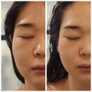 천안윤곽관리 샵토탈뷰티살롱 작은얼굴관리로 다시태어나다!