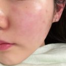 요즘의 피부 기록 일지