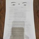 토마스병원 | 앞트임 복원 흉터제거 발품 후기｜병원 결정 완료