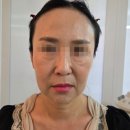 가담뷰티 | 성남 피부관리 50대 탄력 동안리프팅은 보다뷰티 성남본점