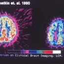 성인 adhd 진실 이미지