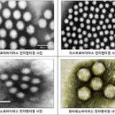 노로바이러스 및 원인 검사 전염성 잠복기 회복 격리 음식 이미지