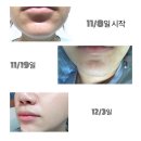 이오스타 이미지