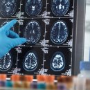 뉴로메디칼 이미지