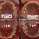 연세미소담은치과 이미지
