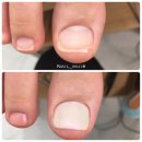 mui_nail